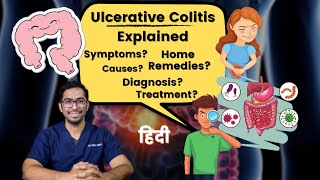 Ulcerative Colitis Diet Plan  Symptoms Treatment Explained  Dr Vishal Tomar  Open Consult [upl. by Altaf194]