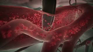 Malaria 3D Animation Shows How the Infection Spreads in the Body [upl. by Buonomo174]