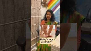 Bow legs in babies youtubeshortsyoutubepediatricsdoctorbabyparentingbabycaretipseducation [upl. by Ulric]