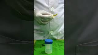 Semen Analysis Test Lab  Check pH  male reproductive systemseminal semen science chemistry [upl. by Lotsyrk777]