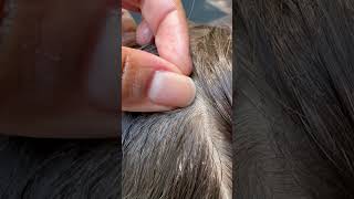 Picking Lice l Lice Removal l Small Business explore hair backtoschool [upl. by Moncear]