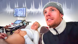 VOOR HET EERST NAAR DE HARTSLAG LUISTEREN👶🏼  baby vlog 3 [upl. by Aralc]