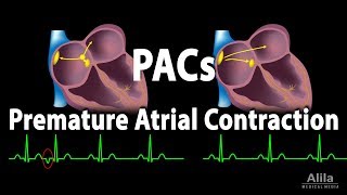 Premature Atrial Contractions PACs Animation [upl. by Fernyak]