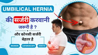 What is Umbilical Hernia in Hindi  Umbilical Hernia  Causes Recovery Symptoms amp Treatment [upl. by Doralynn]