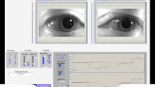 Eye Video Saccade Horizontalwmv [upl. by Frantz]