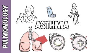 Understanding Asthma  pathophysiology and treatment [upl. by Siriso875]