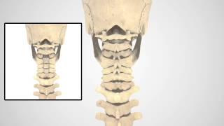 PCF Patient Animation [upl. by Josephson]