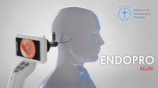 Introducing the MultiDisciplinary Use of the AED ENDOPROCAM® Elite [upl. by Haet262]