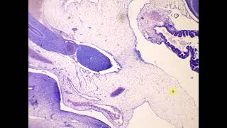 Mesenchymal mucoid embryonal c t 10mm Pig Embryo [upl. by Apurk]