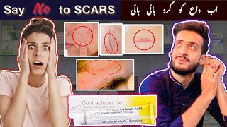 Contractubex Gel  Say “NO” to SCARS  Get rid fo scars Quickly  Merz Pharma Germany 🇩🇪 [upl. by Ennalyrehc]