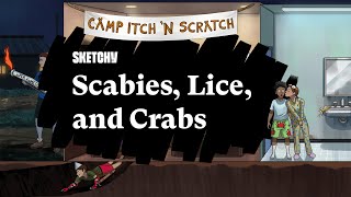 Scabies Lice amp Crabs A Study Guide Part 1  Sketchy Medical  USMLE Step 1 [upl. by Chanda]