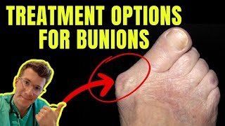 Doctor explains BUNION TREATMENT OPTIONS [upl. by Ahsyak]