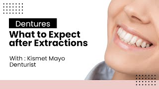 What to expect with extractions and dentures [upl. by Aihsekin]