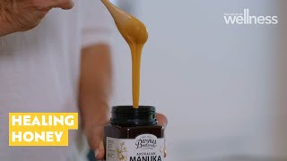 Surprising uses for manuka honey [upl. by Inoliel98]