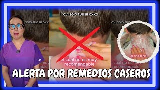 DOCTORA ALERTA POR REMEDIOS CASEROS PARA QUEMADURA SOLAR I JAVIER DERMA [upl. by Orecic323]