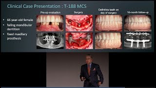 An introduction to the Trefoil system by Dr Kenji Higuchi [upl. by Ennairej]