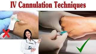 How To Insert IV Cannula  IV Cannulation Techniques [upl. by Biron732]