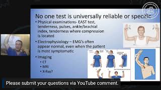 No one test is universally reliable or specific for Thoracic Outlet Syndrome [upl. by Tristam]