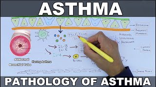 Asthma  Pathophysiology of Asthma [upl. by Heinrich]