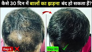 30 Days Thin To Thick Hair Challenge  Hair Regrowth Tips For Men  Hair Growth Tips  Dhru Rao [upl. by Averil]