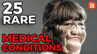 25 Rare Medical Conditions You Never Heard Of [upl. by Wolpert]