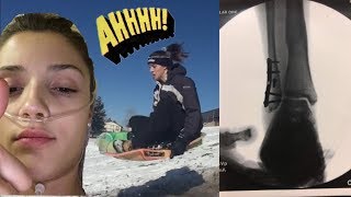 Broken Ankle Sledding Accident ON VIDEO [upl. by Eselahs]