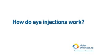 How do eye injections intravitreal injections work [upl. by Grantley]