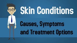 Skin Conditions  Causes Symptoms and Treatment Options [upl. by Netsuj113]