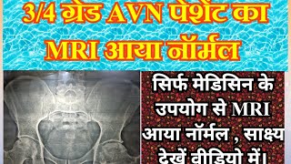 avn ka ayurvedic treatmentavn ka ilaj ayurveda avascularnecrosis [upl. by Eanad]