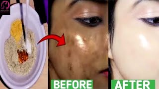 Natural Face Mask for Fresh and Glowing Skin  Home Remedy You NEED These Face Masks For Dullness [upl. by Atnahsal479]