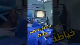 Arthroscopic Rotator cuff repair [upl. by Yerffoej]