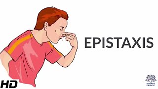 Epistaxis Causes SIgns and Symptoms Diagnosis and Treatment [upl. by Shepherd692]