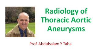 Radiology of Thoracic Aortic Aneurysms [upl. by Guido]