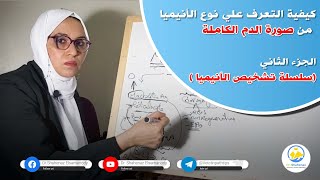 كيفية التعرف علي نوع الأنيميا من صورة الدم الكاملة  الجزء الثاني  سلسة تشخيص نوع الأنيميا [upl. by Redmond]