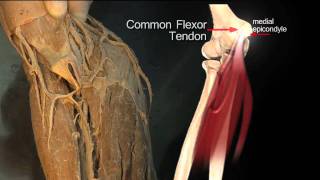 Forearm Flexor Compartment Superficial Muscles  Anatomy Tutorial [upl. by Ennayram913]