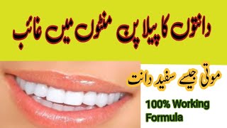 Teeth Whitening At Home 100 Working Formula  Home Remedy [upl. by Annas]