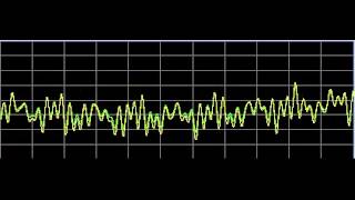 Nervous System Disorders  Rife Frequencies [upl. by Klemperer]