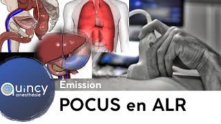 Point Of Care Ultrasound autour de lALR [upl. by Nimocks]