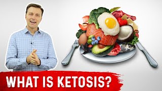 What is Ketosis  Dr Berg [upl. by Sugna]