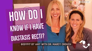 How do you know if you have diastasis recti and what should you do if you have it [upl. by Hiasi]