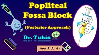 PNS guided Popliteal Sciatic Nerve Block  Intertendinous Approach  Popliteal Fossa Block [upl. by Ettelra633]