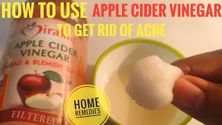 How to use APPLE CIDER VINEGAR to get rid of acne  how to use apple cider vinegar for flawless skin [upl. by Akima]