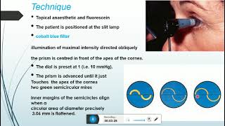 goldmann and other forms of tonometry [upl. by Aicilet]