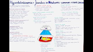 Hyperbilirubinemia  Jaundice in Newborns  common  rare causes [upl. by Ludmilla313]