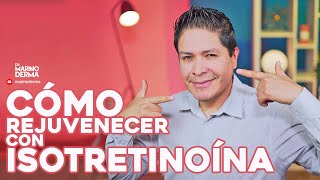 COMO REJUVENECER TU PIEL CON ISOTRETINOINA [upl. by Erreit]