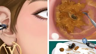 Watching is Addicted Ear WaxRemoval ASMR Close Up Latest EarCleaning asmr earwax earwaxremoval [upl. by Lia69]