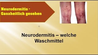 Neurodermitis Welche Waschmittel bei Neurodermitis  GANZMEDIZIN Naturheilpraxis [upl. by Wilonah]