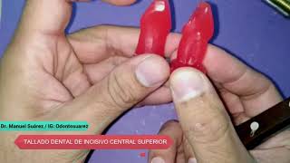 Tallado Dental UD Incisivo Central Superior En Taco de cera  Parte 2 [upl. by Symer]