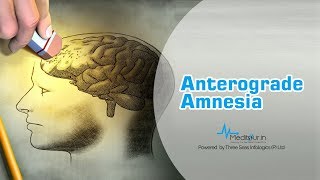 Anterograde amnesia [upl. by Aicemaj]