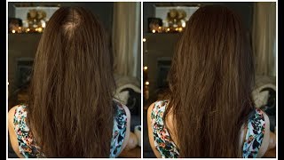 How To Get Rid Of A Cowlick In The Front SO EASY [upl. by Atiken66]